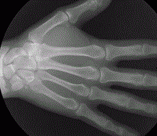  X-ray   GIF,    